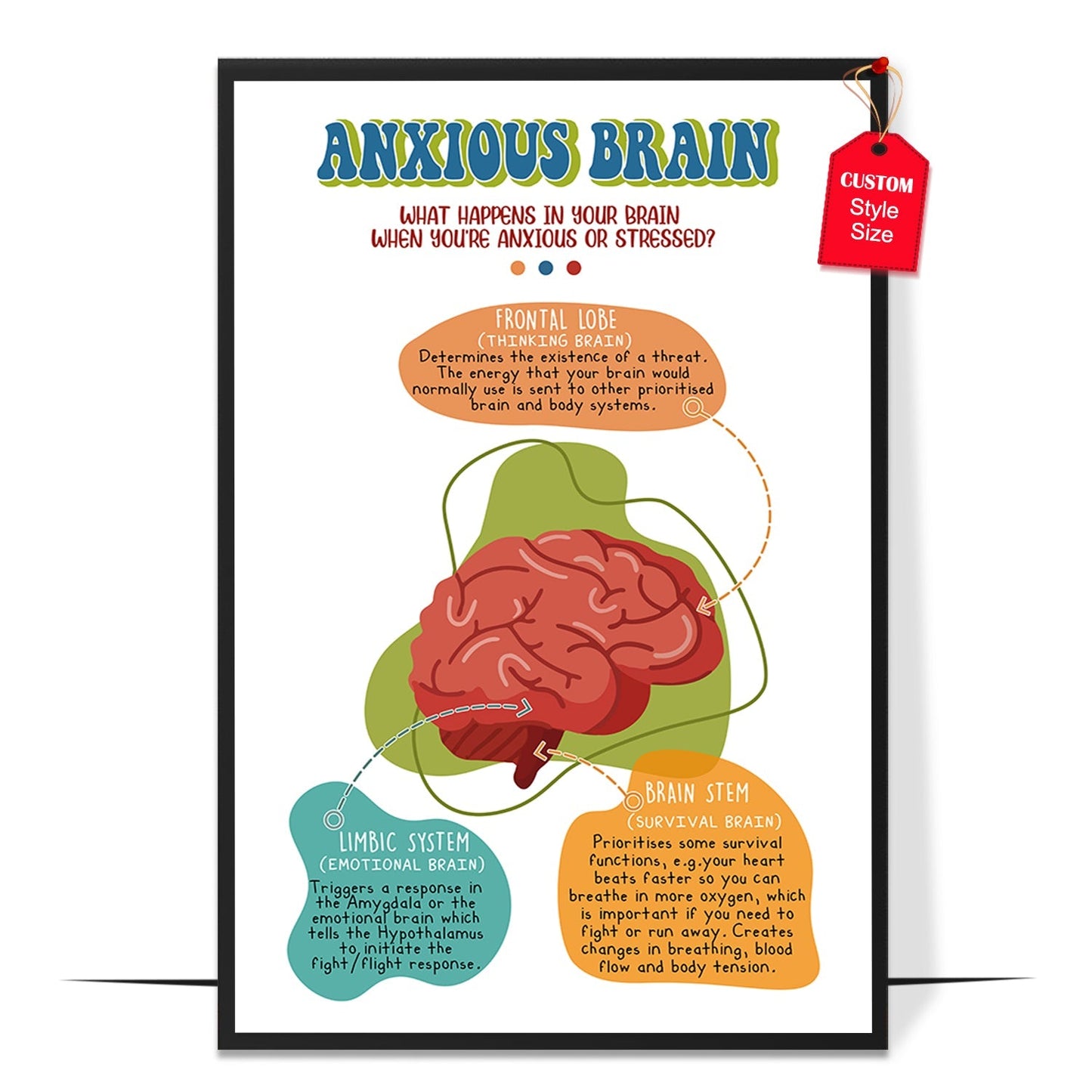 Anxious Brain Poster