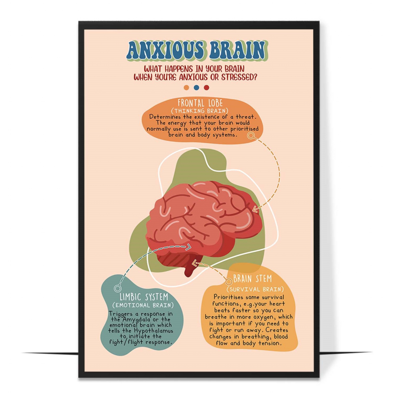Anxious brain poster — A simple, boho-styled map of what happens in an anxious br