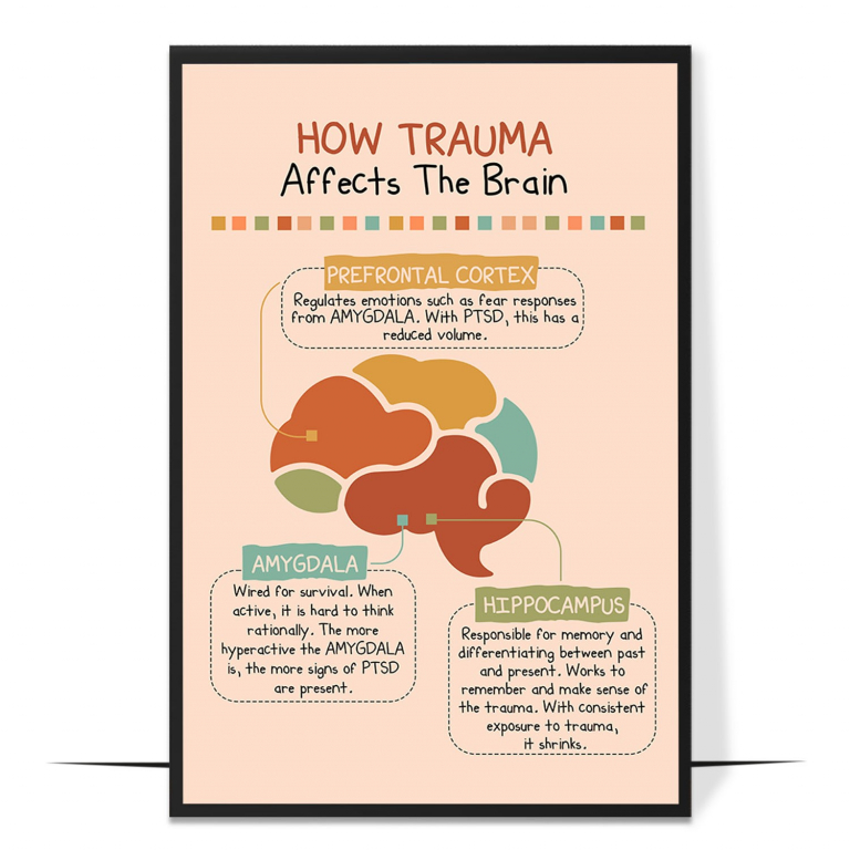 Trauma and the brain poster — A simple map of the brain regions trauma affects, framin